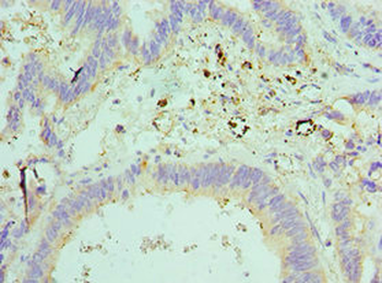 ELOB Antibody