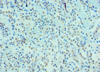 CRY2 Antibody