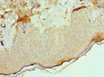 ACVR2A Antibody