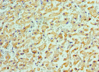 ACVR2A Antibody