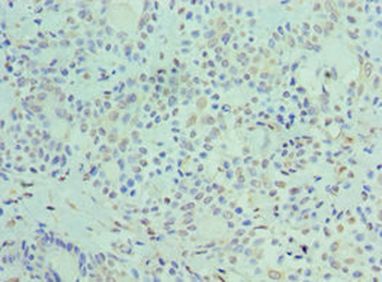 PLIN2 Antibody
