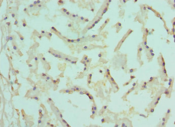 ATF1 Antibody