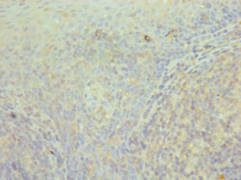 CCT3 Antibody