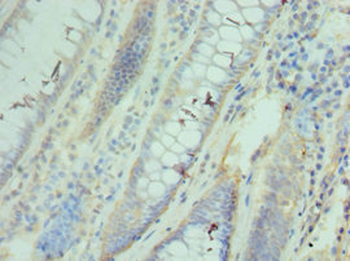 CCT3 Antibody
