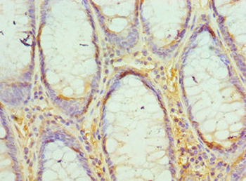 EED Antibody