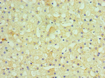 HSD11B1 Antibody