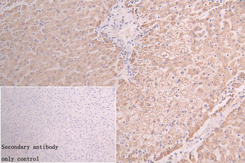 GATM Antibody