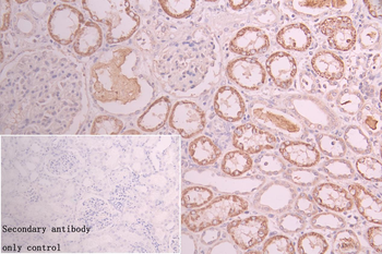 GATM Antibody