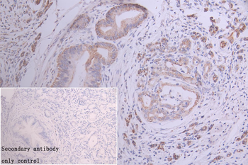GATM Antibody