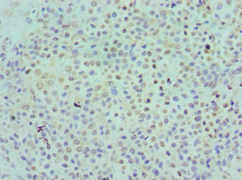 KIR2DS4 Antibody