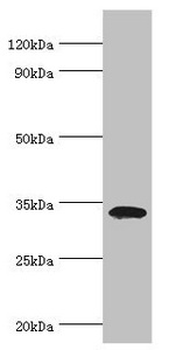 LDLRAP1 Antibody