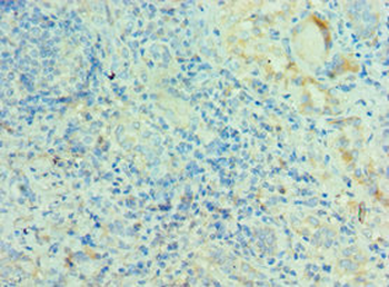 MRPL28 Antibody