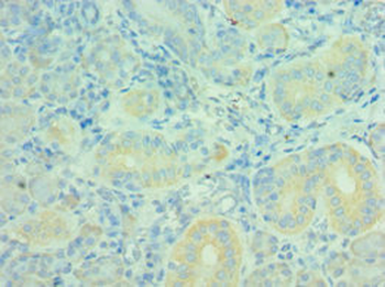 MTM1 Antibody