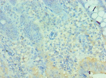 MTM1 Antibody