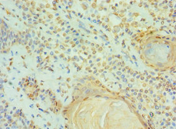 CCAR1 Antibody