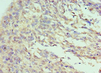 ILF3 Antibody