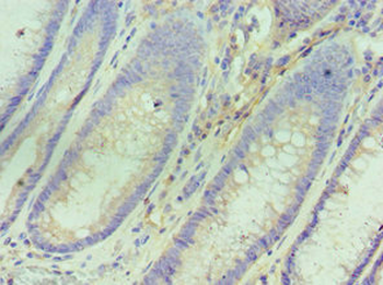 IL10RA Antibody