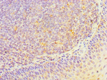 HOXA1 Antibody