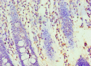 HOXA1 Antibody