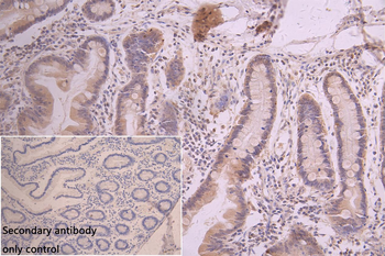 EEF2KMT Antibody