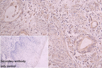 EEF2KMT Antibody