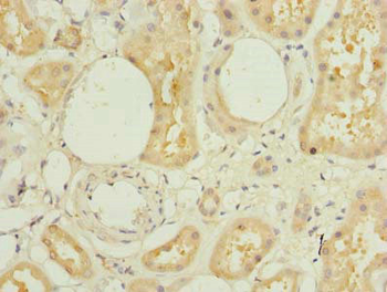 L3HYPDH Antibody