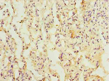 L3HYPDH Antibody