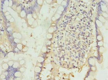 PDCD1 Antibody