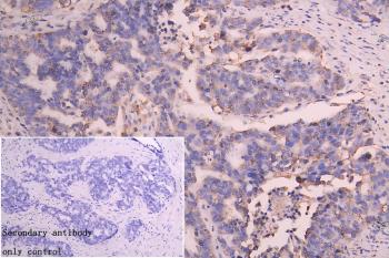 SLC25A51 Antibody