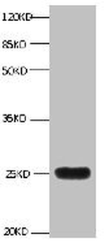 LCN2 Antibody