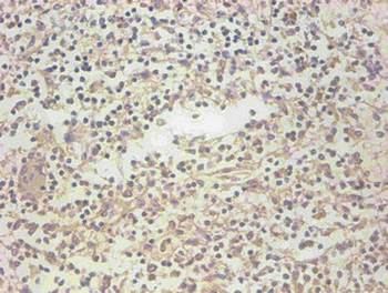 LCN2 Antibody