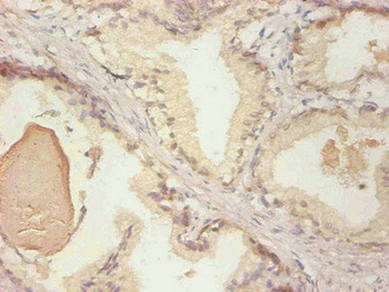 LCN2 Antibody