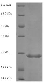 Human C5 protein