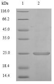 Mouse Camk2n1 protein