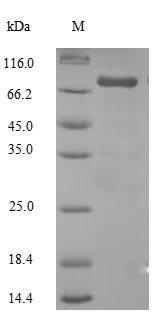Human CYP17A1 protein