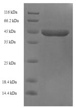 Human ETHE1 protein