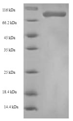 Human HNRNPL protein