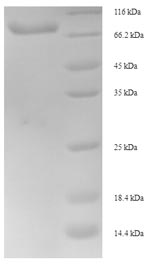 Human ITPKB protein