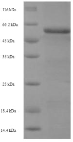 Human SERPINE2 protein