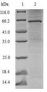Human SSB protein