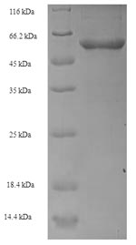 Human TCN1 protein