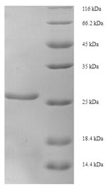 Human XRCC5 protein