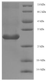 Plant Ribosome-inactivating protein lychnin protein