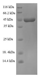 Viral GP protein