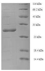 Viral vpx protein