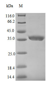 Viral NP protein