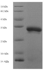 Drosophila UbcD6 protein