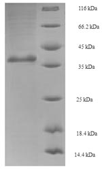Fungi GSP1 protein