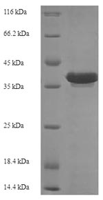 E. coli recR protein