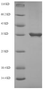 Plant PR10A protein